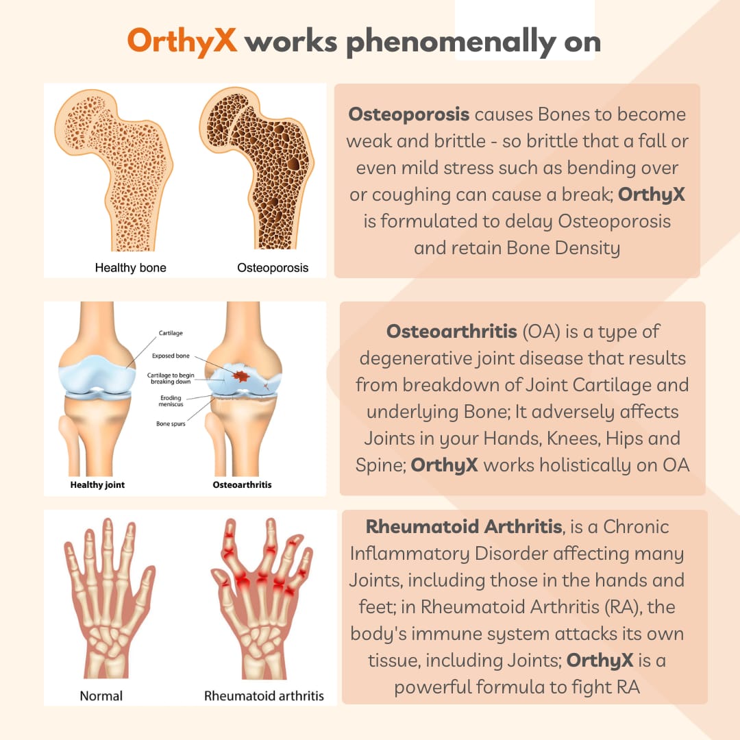 OrthyX  for Men 100gm